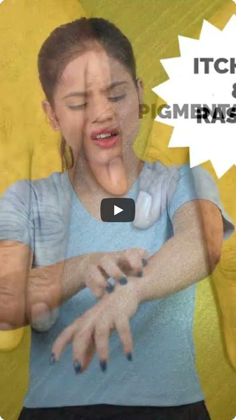 The Frightening Side of Whitening Creams