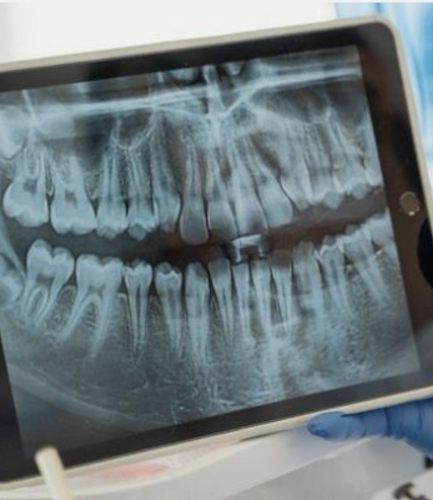 teeth radiography
