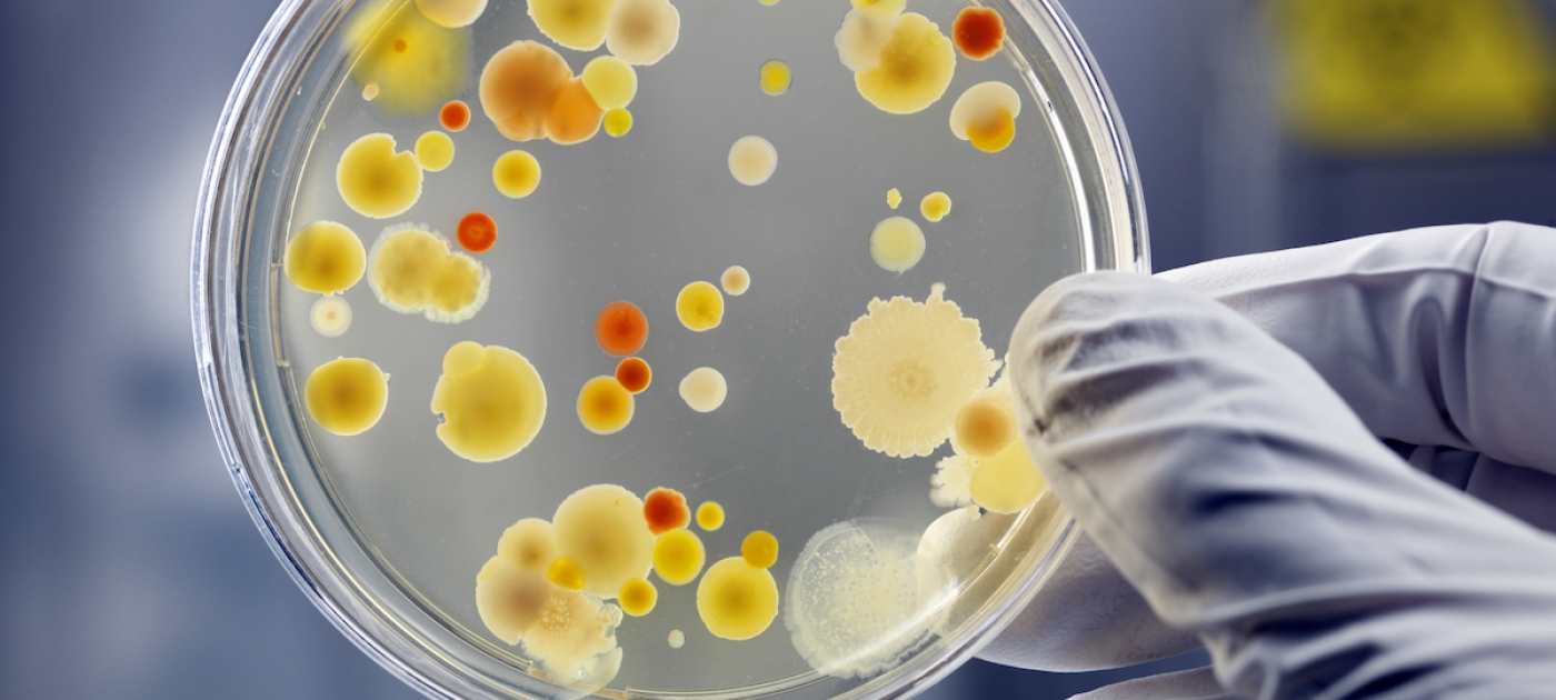 Under the microscope: the rise of antimicrobial resistance Photo: Getty Images/Andreas Reh