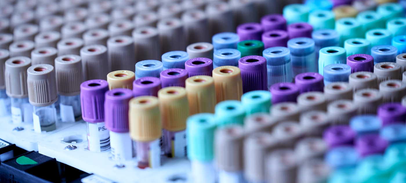 One Health approach to tackle antimicrobial resistance Photo by Unsplash