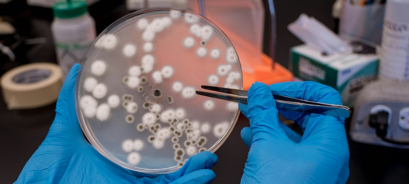 A person holding a petri dish